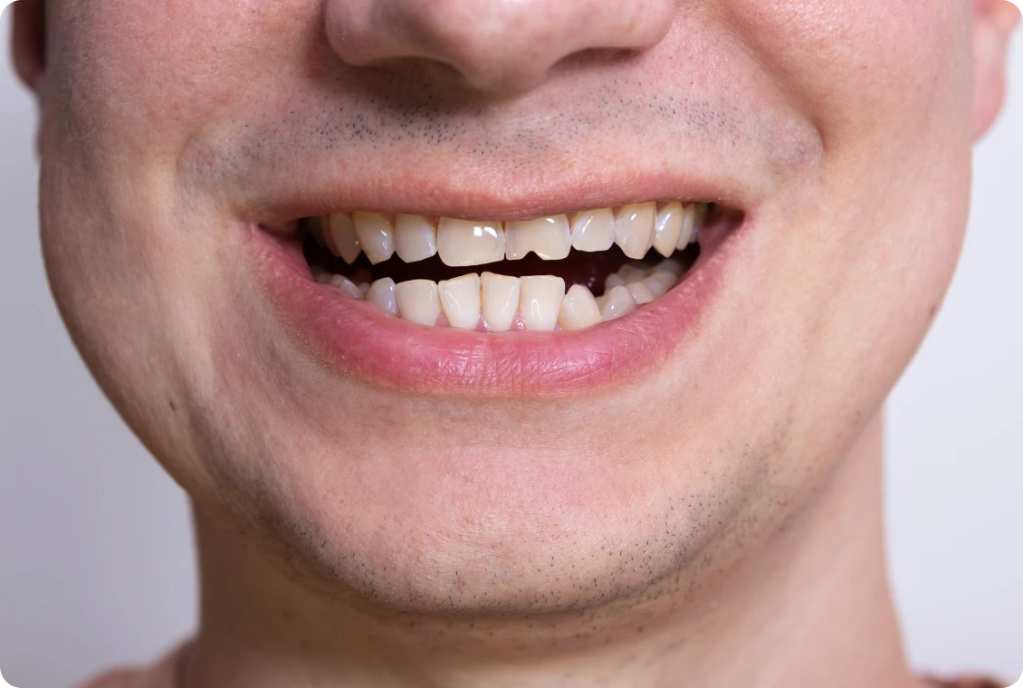Smiling person showing teeth close-up.